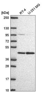 PRMT1 Antibody in Western Blot (WB)