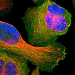 SNAP23 Antibody in Immunocytochemistry (ICC/IF)