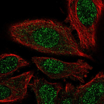 PSMD7 Polyclonal Antibody