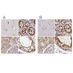 PSMD7 Antibody in Immunohistochemistry (Paraffin) (IHC (P))