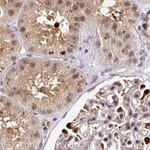 PSMD7 Antibody in Immunohistochemistry (Paraffin) (IHC (P))