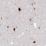 PSMD7 Antibody in Immunohistochemistry (Paraffin) (IHC (P))
