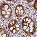 PSMD7 Antibody in Immunohistochemistry (Paraffin) (IHC (P))