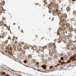PSMD7 Antibody in Immunohistochemistry (Paraffin) (IHC (P))