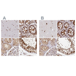 PSMD7 Antibody in Immunohistochemistry (Paraffin) (IHC (P))