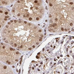 PSMD7 Antibody in Immunohistochemistry (Paraffin) (IHC (P))