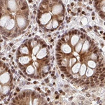 PSMD7 Antibody in Immunohistochemistry (Paraffin) (IHC (P))