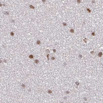 PSMD7 Antibody in Immunohistochemistry (Paraffin) (IHC (P))