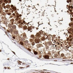 PSMD7 Antibody in Immunohistochemistry (Paraffin) (IHC (P))
