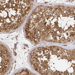 Kinesin 5B Antibody in Immunohistochemistry (Paraffin) (IHC (P))
