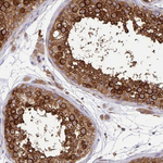 Kinesin 5B Antibody in Immunohistochemistry (Paraffin) (IHC (P))