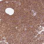 Catenin alpha-1 Antibody in Immunohistochemistry (Paraffin) (IHC (P))