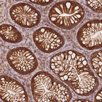 Catenin alpha-1 Antibody in Immunohistochemistry (Paraffin) (IHC (P))