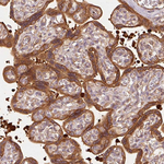 Catenin alpha-1 Antibody in Immunohistochemistry (Paraffin) (IHC (P))