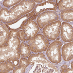 Catenin alpha-1 Antibody in Immunohistochemistry (Paraffin) (IHC (P))