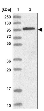Catenin alpha-1 Antibody in Western Blot (WB)