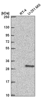 XRCC3 Antibody in Western Blot (WB)
