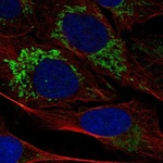 TSPO Polyclonal Antibody