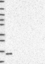 TSPO Antibody in Western Blot (WB)