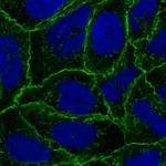 Catenin alpha-1 Antibody in Immunocytochemistry (ICC/IF)