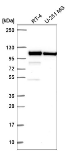 Catenin alpha-1 Antibody in Western Blot (WB)