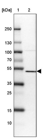 SETD7 Antibody in Western Blot (WB)