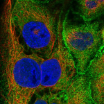 Villin Polyclonal Antibody
