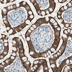 Villin Antibody in Immunohistochemistry (Paraffin) (IHC (P))