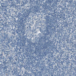 Villin Antibody in Immunohistochemistry (Paraffin) (IHC (P))
