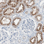 Villin Antibody in Immunohistochemistry (Paraffin) (IHC (P))