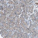 Villin Antibody in Immunohistochemistry (Paraffin) (IHC (P))
