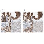 Villin Antibody in Immunohistochemistry (Paraffin) (IHC (P))