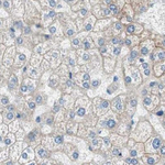 Villin Antibody in Immunohistochemistry (Paraffin) (IHC (P))