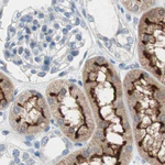 Villin Antibody in Immunohistochemistry (Paraffin) (IHC (P))