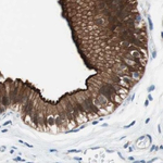 Villin Antibody in Immunohistochemistry (Paraffin) (IHC (P))