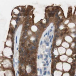 Villin Antibody in Immunohistochemistry (Paraffin) (IHC (P))