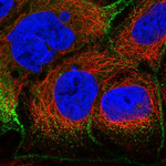 Villin Polyclonal Antibody