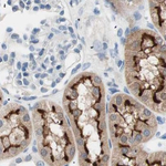Villin Antibody in Immunohistochemistry (Paraffin) (IHC (P))