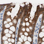 Villin Antibody in Immunohistochemistry (Paraffin) (IHC (P))
