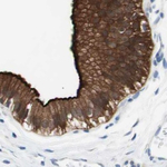 Villin Antibody in Immunohistochemistry (Paraffin) (IHC (P))