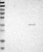 CD226 Antibody in Western Blot (WB)