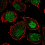 ASF1A Polyclonal Antibody