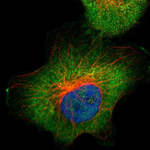 Aldolase A Polyclonal Antibody