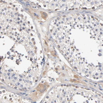 Aldolase A Antibody in Immunohistochemistry (Paraffin) (IHC (P))