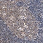 Aldolase A Antibody in Immunohistochemistry (Paraffin) (IHC (P))