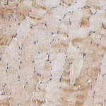 Aldolase A Antibody in Immunohistochemistry (Paraffin) (IHC (P))