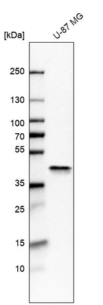 Aldolase A Antibody in Western Blot (WB)