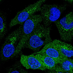 PKLR Antibody in Immunocytochemistry (ICC/IF)