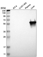 PKLR Antibody in Western Blot (WB)