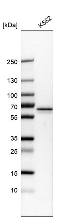 PKLR Antibody in Western Blot (WB)